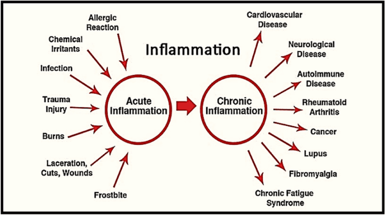 Understanding Inflammation