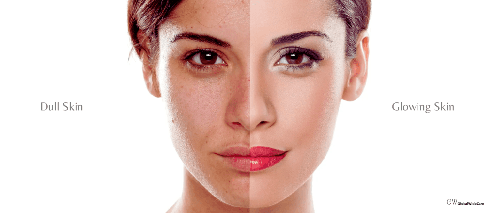 Dull skin versus radiant skin