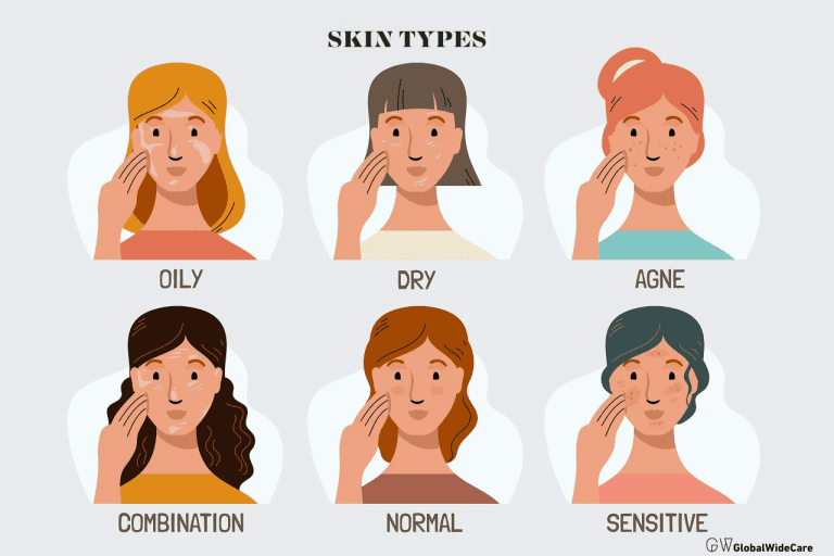 Skin Types