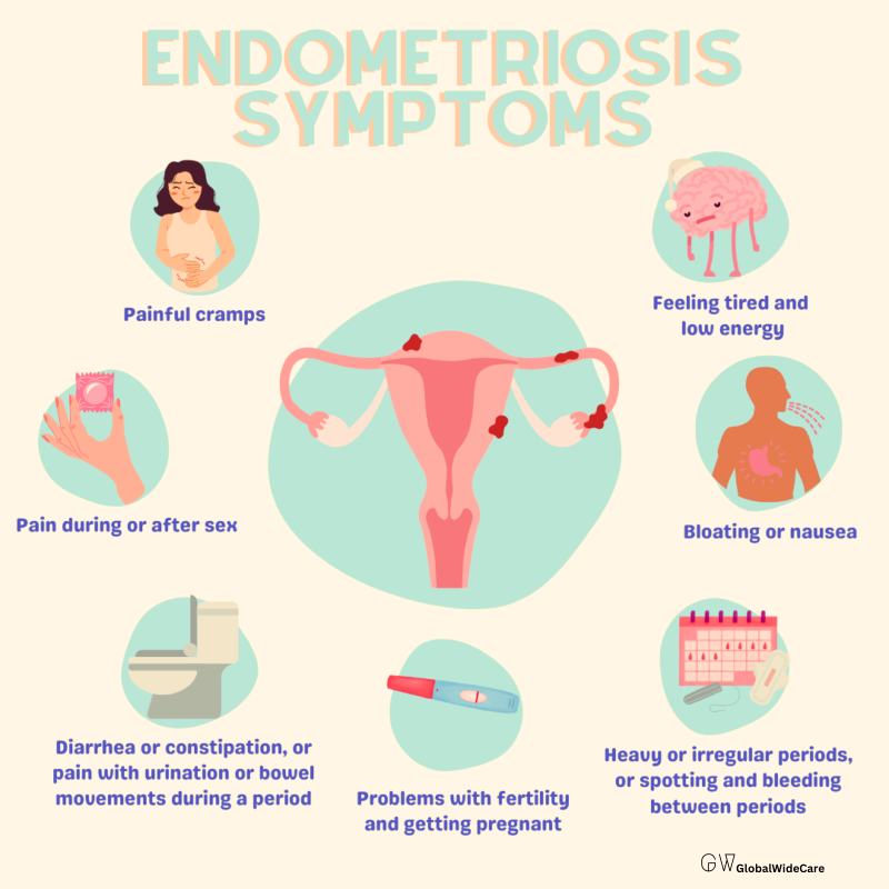 Key Symptoms of Endometriosis