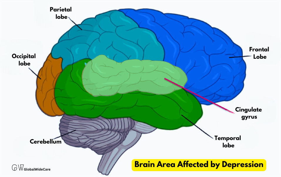 brain with highlighted areas affected by depression