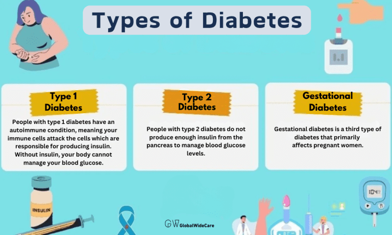 Types of Diabetes